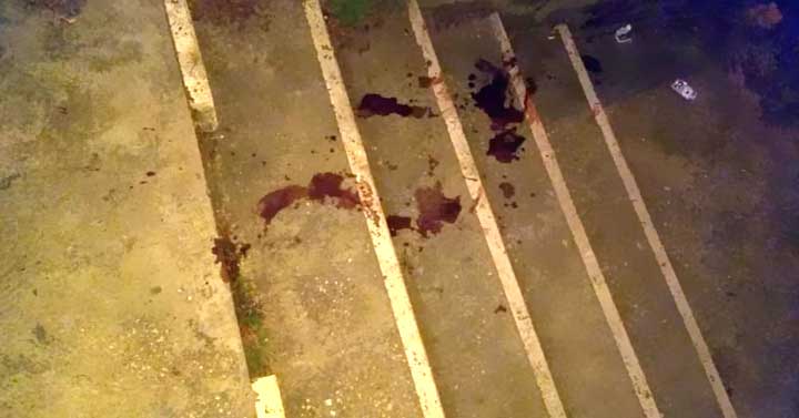 Colleferro-scalinata-V-F-Oste-L-Michelangelo-sangue